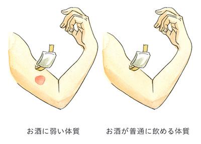 お酒に弱い体質　お酒が普通に飲める体質