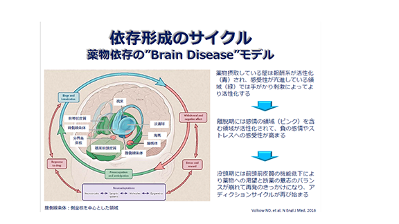 依存形成のサイクル 薬物依存の”Brain Disease”モデル